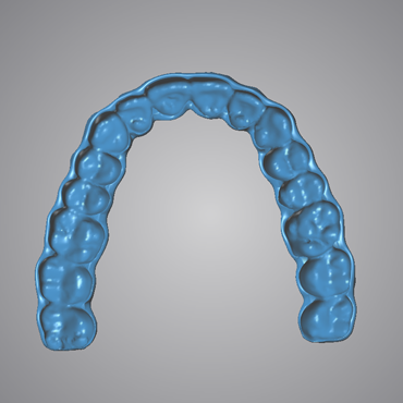 Dental Design Bite