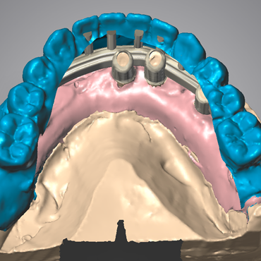 Dental Design Cad