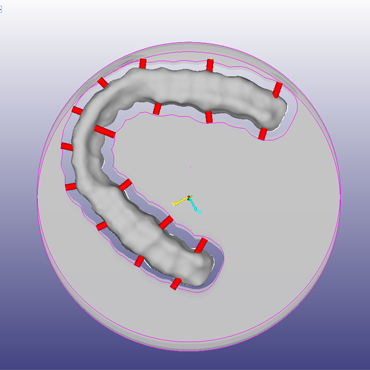 Dental Design Cam