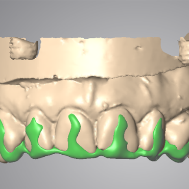 Dental Design Grillz