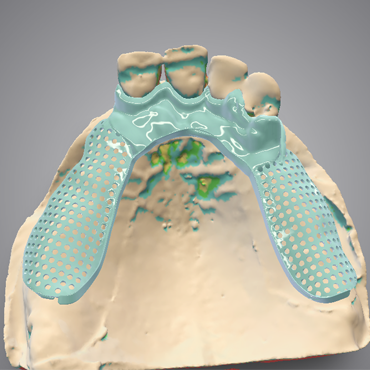 Dental Design Scheletrato