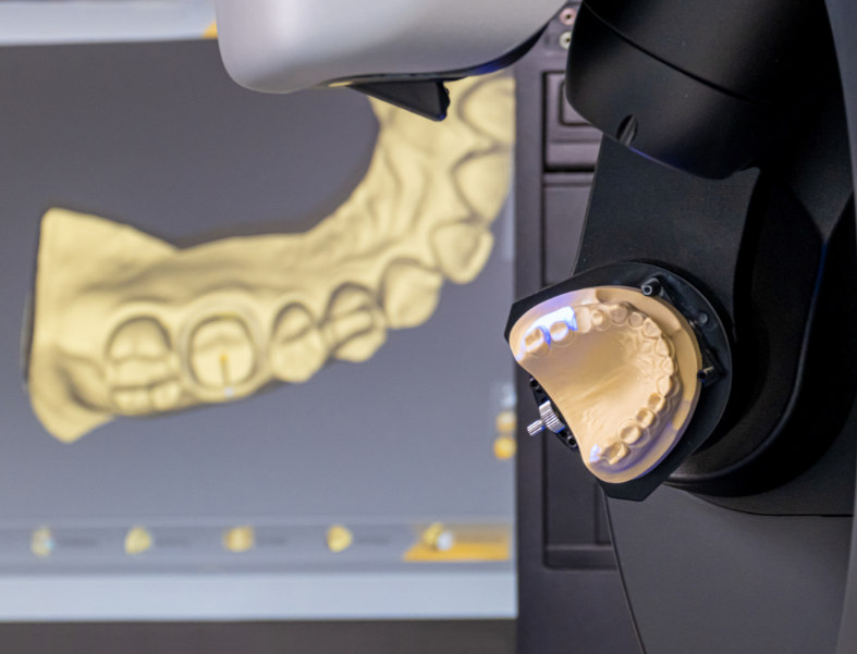 Scansione di un modello dentale per il flusso CAD